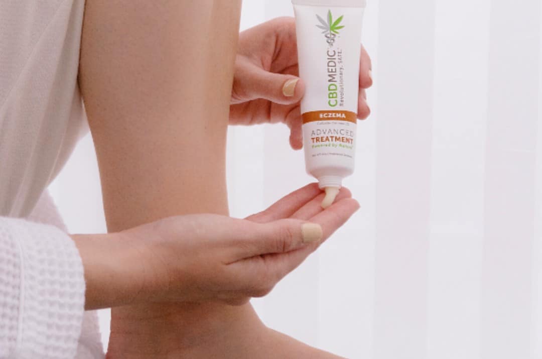 Leg and hand - CBD MEDIC Eczema Therapy Medicated Ointment