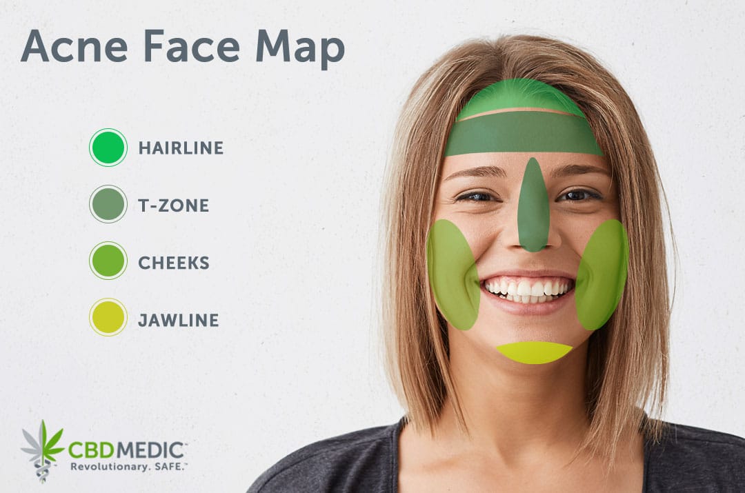Acne Facemap